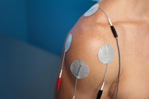 What Is E-Stim Therapy (& How Does It Work)? - Oviedo Chiropractic